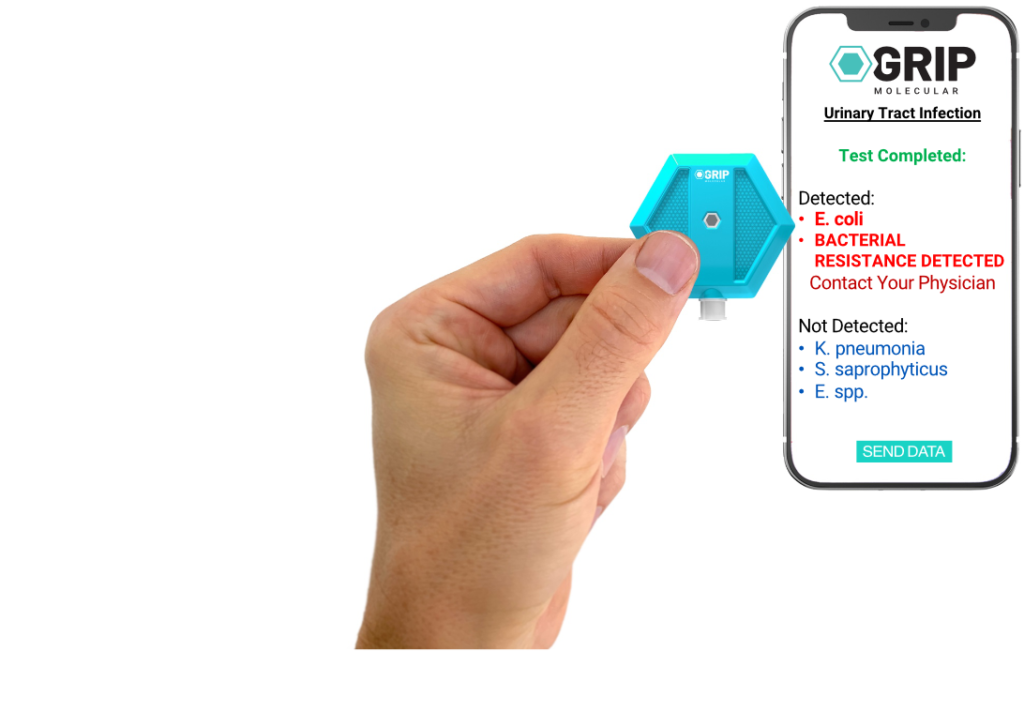 Hand holding UTI test chip next to Cell Phone showing lab results